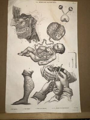 Antique Estampe 1834 Anatomy Medicine Surgery Doctor Doctor Botany