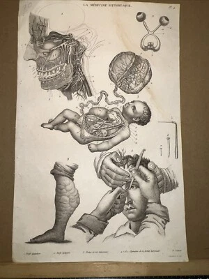 Antiquarische Estampe 1834 Anatomie Medizine Chirurgie Arzt Doktor Botanik - Bild 1 von 4