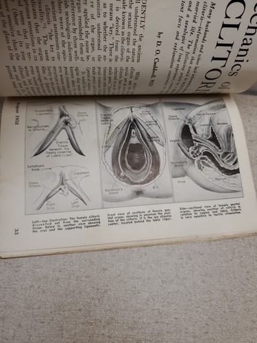 Sexology Magazine August 1952 - Picture 11 of 11