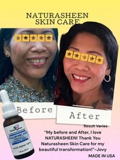 HYALURONIC + VITAMIN C + MATRIXYL 3000 SERUM. Brightening, Hydrating &Firming.