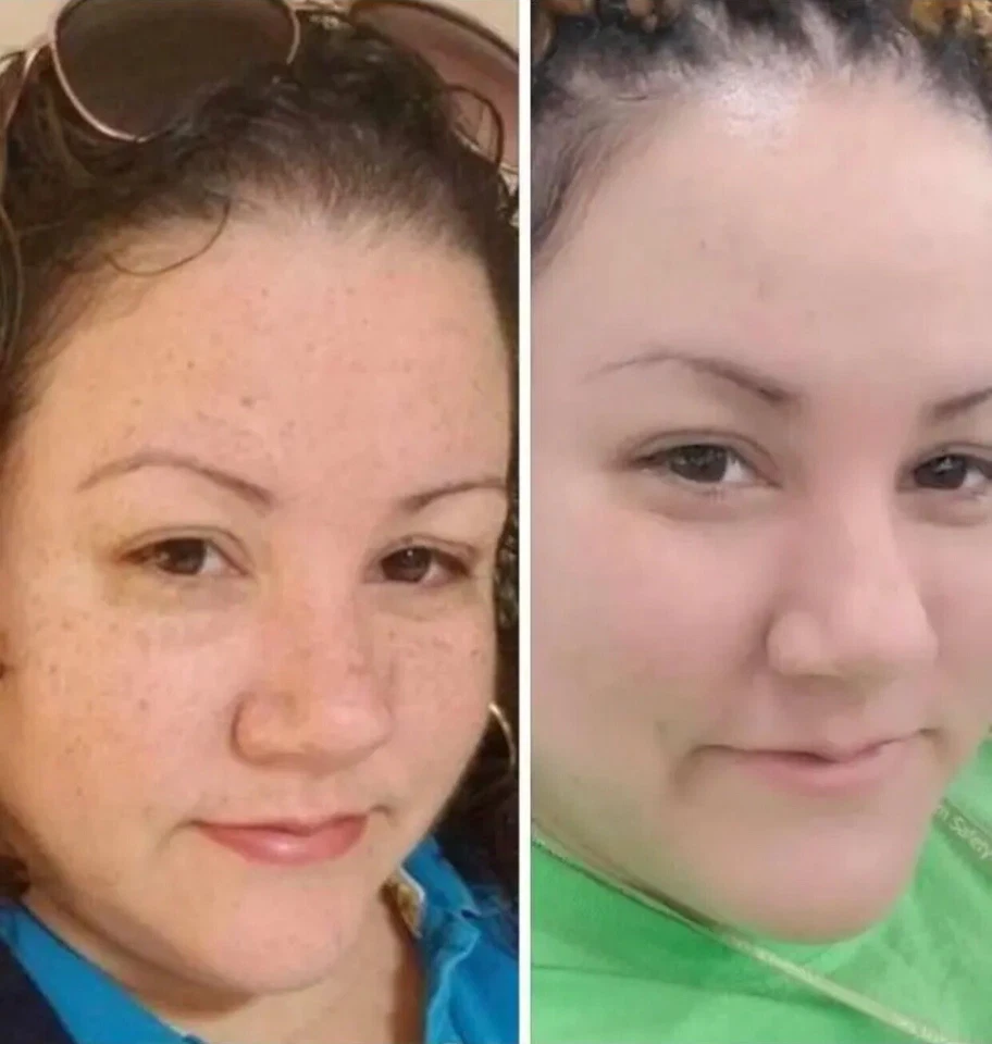 Sammy Skincare Dark Spots Remover Cream Extra Strength, 2oz Per Unit. - Image 2 of 4