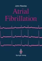 Atrial Fibrillation John Rawles