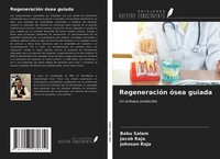 RegeneracióN óSea Guiada Babu Salam