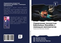 Uprawlenie Polnost'ü Edentulous Mandible S Pomosch'ü Implantatow Bineet Kumar