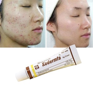 neck pigmentation removal cream