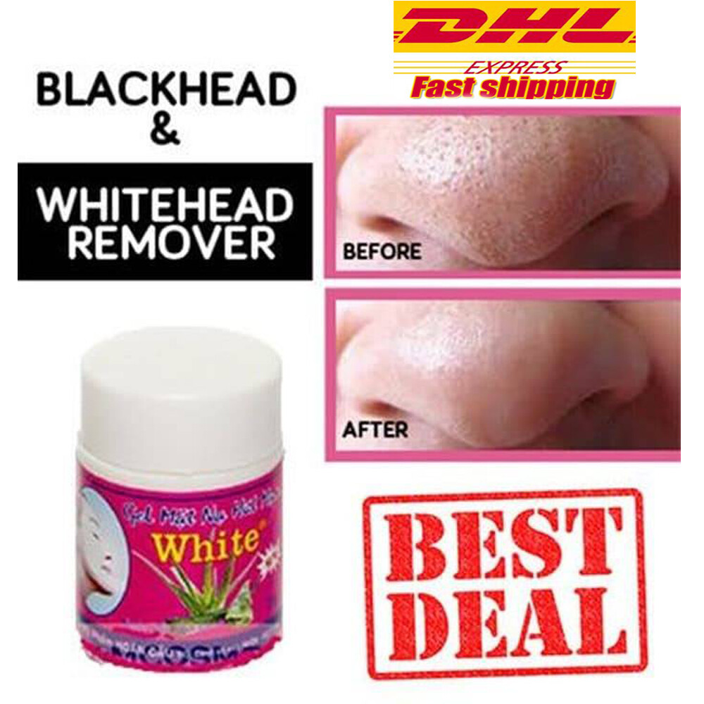 Whiteheads Removal Cream
