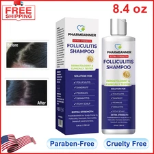 Anti-Fungal Shampoo for Folliculitis Seborrheic Dermatitis Scalp Psoriasis 8.4oz
