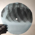 PINK FLOYD TAKE UP THY STETOSCO X-Ray USSR Record Roentgen Bone Ribs Music Vinyl
