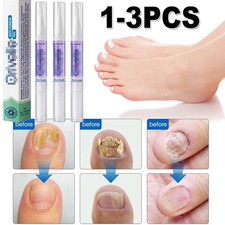 NEW Anti Fungal Pen Intensive Treatment Toenail Fungus Foot Nail Repair Oil