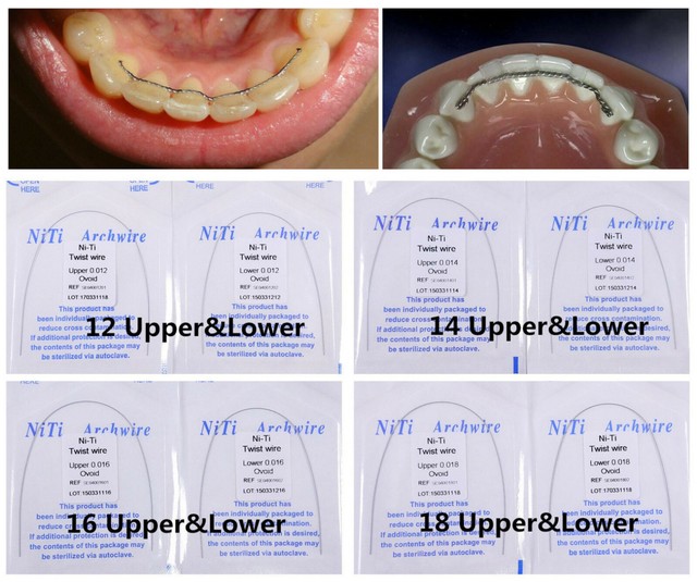 10x Dental Orthodontic Twist Arch Wire Niti Oval Lingual Retainer