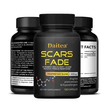 Glutathione Whitening Pills Dark Spots, Melasma & Acne Scar Remover Glutathione