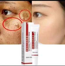 Whitening Freckles Spot Remover for Face Dark Spot Corrector-Hyperpigmentation