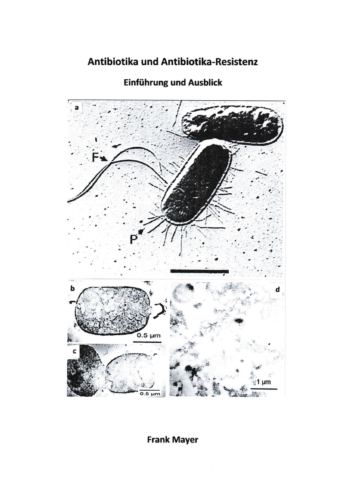 Thumbnail - Frank Mayer | Antibiotika Und Antibiotika-resistenz | Taschenbuch |