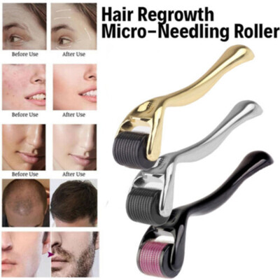 540 Titanium Hair Regrowth Roller System for Beard Growth Anti Hair Loss Therapy