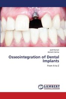 Osseointegration Of Dental Implants Jyoti Kumari