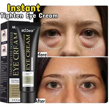 Temporary Eye Tightener Eye Cream, Instant Reduces Under-Eye Bags, Dark Circles