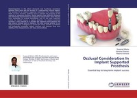 Occlusal Consideration In Implant Supported Prosthesis Reema Srichand