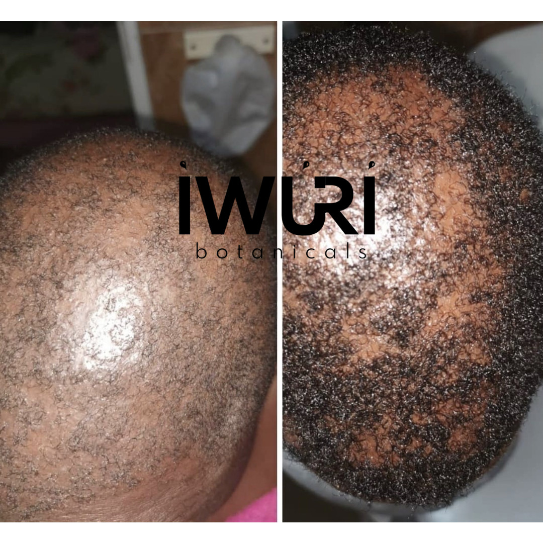 IWURI Botanicals Herbal Growth Butter Scalp Treatment 4C Natural Hair 8oz
