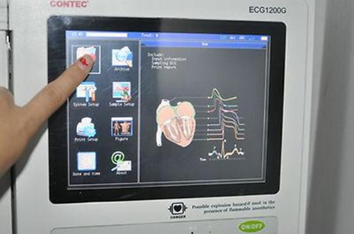 CONTEC ECG1200G Elettrocardiografo ECG digitale 12 canali/piombo, macchina portatile - Foto 10 di 10