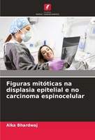 Figuras MitóTicas Na Displasia Epitelial E No Carcinoma Espinocelular, Alka ...