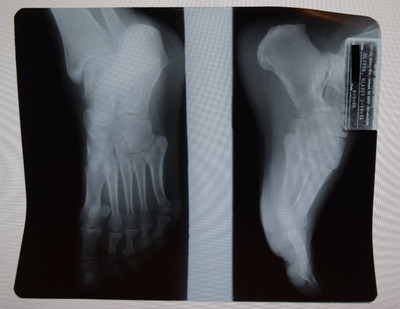 Original Foot X-Ray scan Medical Anatomy Skeleton Bones  - READ DESCRIPTION