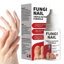 Fungi Nail Anti Fungal Liquid Formula Nail Repair Liquid Solution