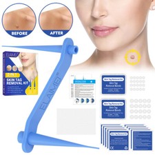 Painless 2in1 Auto Skin Tag 40x Rubber Bands 10x Alcohol Pad Mole Wart Removal