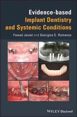 Evidence-based Implant Dentistry and Systemic Conditions by Fawad Javed (English
