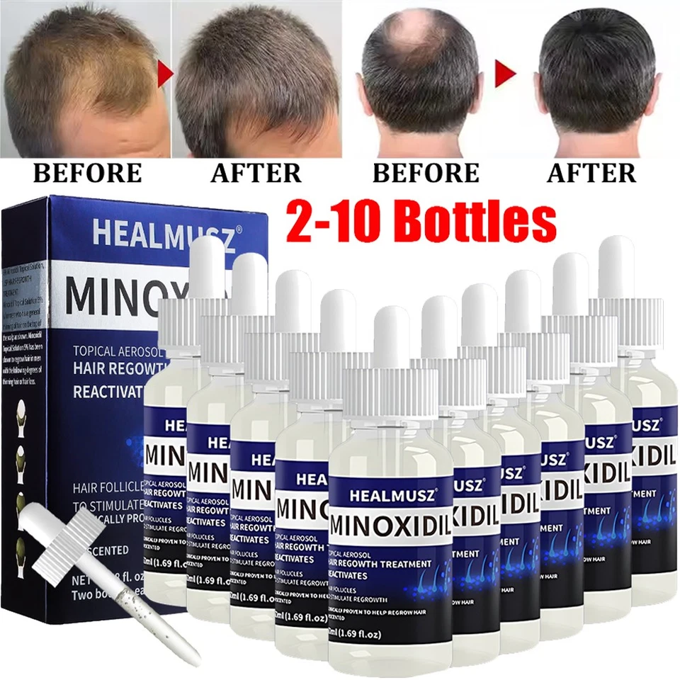 Minoxidil 5% Extra Strength Men 10 Month Supply Hair Regrowth Solution 10Bottles - Image 2 of 4