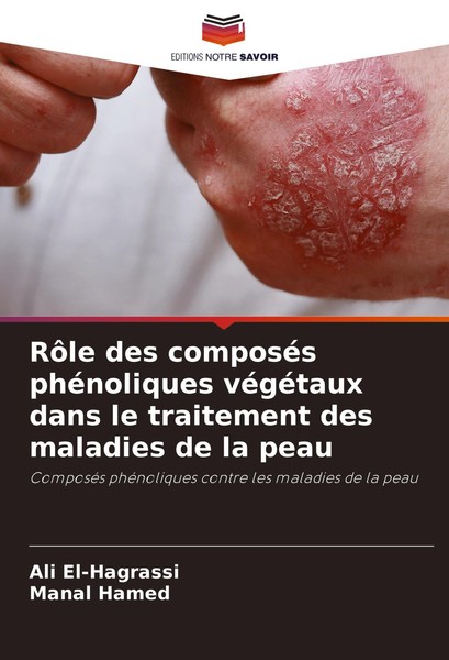 RôLe Des ComposéS PhéNoliques VéGéTaux Dans Le Traitement Des Maladies De La Pea-image