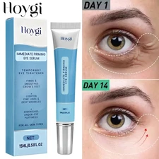 Anti Aging Eye Serum Reduces Under-Eye Bags, Wrinkles, Dark Circles, Fine Lines