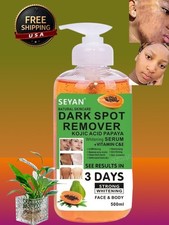 Kojic Papaya Skin Whitening Serum Face Body Darkspots Remover, 500ml USA Stock