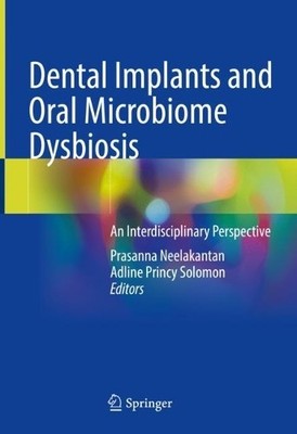 Dental Implants and Oral Microbiome Dysbiosis - 9783030990138