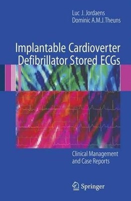 Implantable Cardioverter Defibrillator Stored ECGs: Clinical Management and Case