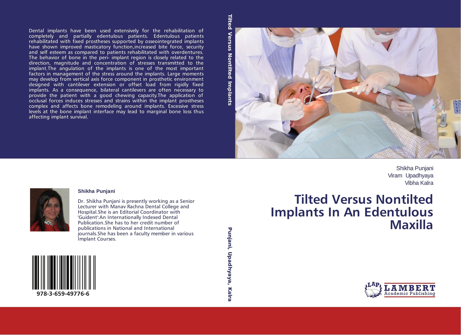 Tilted Versus Nontilted Implants In An Edentulous Maxilla Shikha
