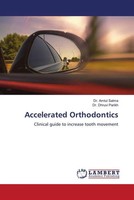 Amtul Salma (U. A.) | Accelerated Orthodontics | Taschenbuch | Englisch (2022)