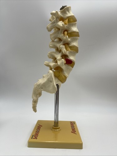 Arcoxia Lendenwirbelsäule Wirbel anatomisches Modell mit Kreuzbein Y - Bild 4 von 5