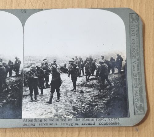 Original WW1 Stereoview Card 3D Wounded On The Menin Road Ypres Around Zonnebeke - Foto 1 di 2