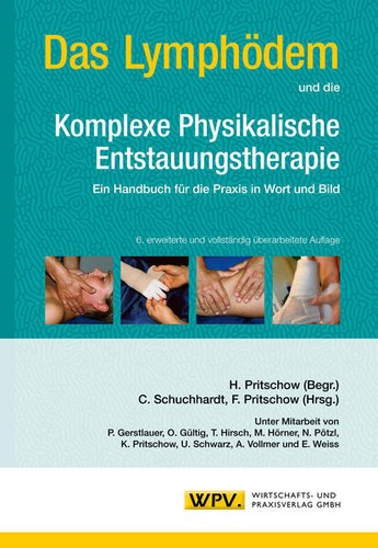Das Lymphödem und die Komplexe Physikalische Entstauungstherapie | deutsch