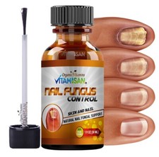 Anti fungal hongo NAILS FUNGUS CONTROL, SUPPORT CONTROL ANTIFUNGAL