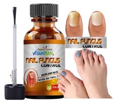 Nail Fungus Support Solution For Toe Fingers Maximum Strength anti fungal sp