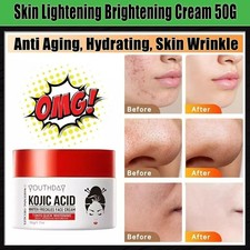 Dark Spot Fade Cream   Skin Lightening  Whitening Bleaching Cream for Face...