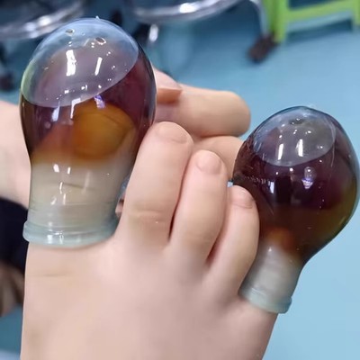 1pc Soft Silicone Toe Protectors, Reduce