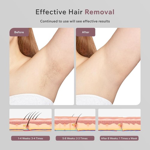 IPL Hair Removal for Women and Men, New Upgraded 999,900 Flashes Permanent Laser - Picture 3 of 7