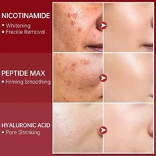 Niacinamide Facial Whitening Serum Moisturising Hyaluronic Acid Remove Dark Spot