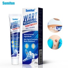 Wart Removal Treatment Cream Plantar Flat Filiform Periungual Common Skin Tag