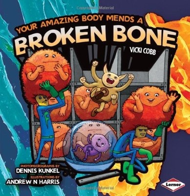 Your Amazing Body Mends a Broken Bone: ..., Cobb, Vicki