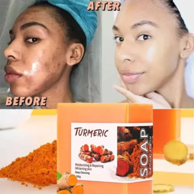 #ad Tumeric Soap Skin Whitening Dark Spots lightening Acne Brightening Turmeric 100g $7.99
