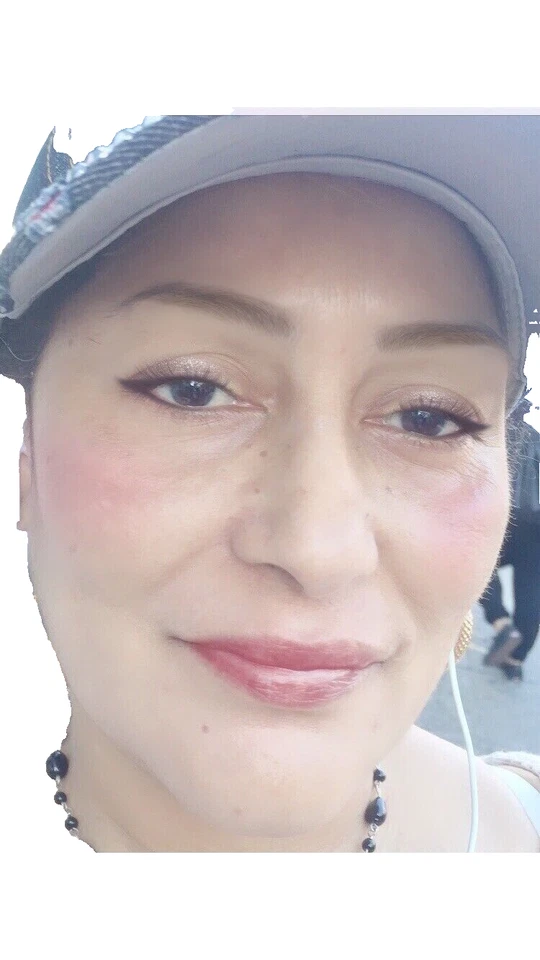 SAMMY DAY CREAM: TE MANTIENE LA PIEL LIBRE DE MANCHAS PROTEGE DE RAYOS UVS - Image 3 of 4