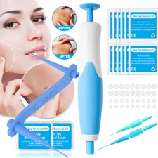 Auto Micro Skin Tag Remover Device Kit Safe Painless Removal 2-8 mm Band Tool
